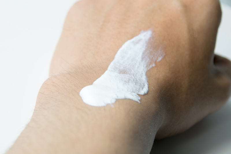 雀斑是如何形成的怎样去除雀斑,脸上长雀斑该怎么正确的去除