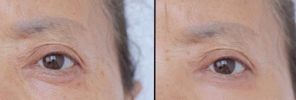 眼霜到底有没有用啊,眼霜里面有什么成分不能用