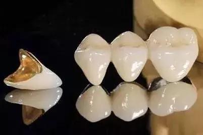 牙齿折断不及时治疗会怎样,牙齿折断了只剩根部