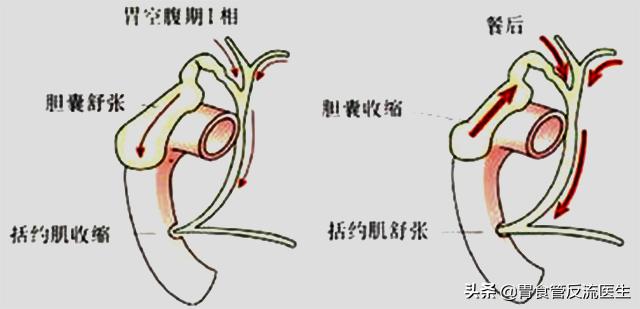 反流性食管炎引起咽喉炎怎样用药,有胃炎和反流性食管炎该怎么用药