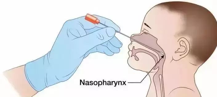 儿童近期流感病毒爆发吃什么药,儿童最近流感病毒怎么治疗