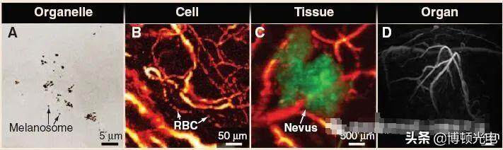 激光技术哪些领域好,激光行业的关键技术