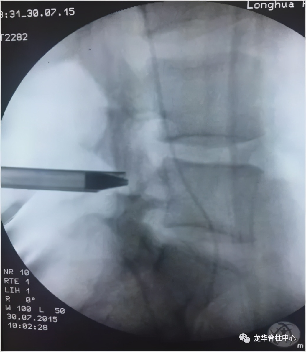 深圳市龙华区人民医院脊柱外科简介