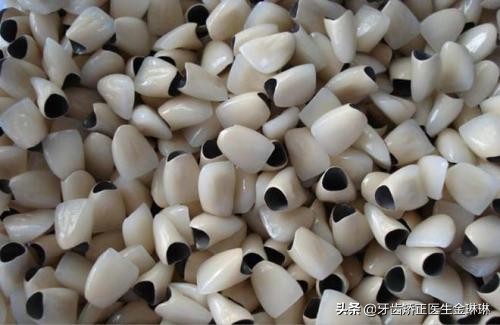 山东最便宜的烤瓷牙,18年北京烤瓷牙价格是多少