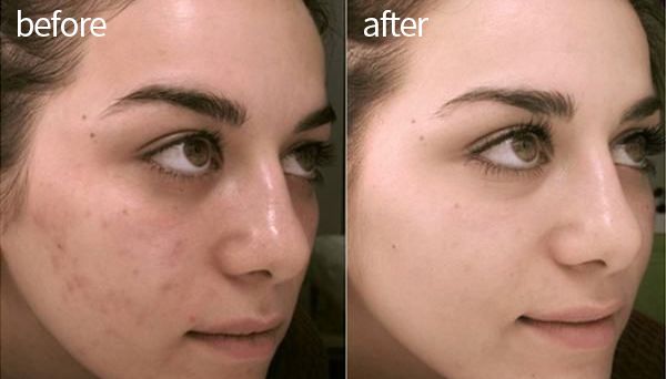 琚佸濮楁帹鑽愯憽钀勭苯鎶よ偆,琚佸濮楄憽钀勭苯绮惧崕