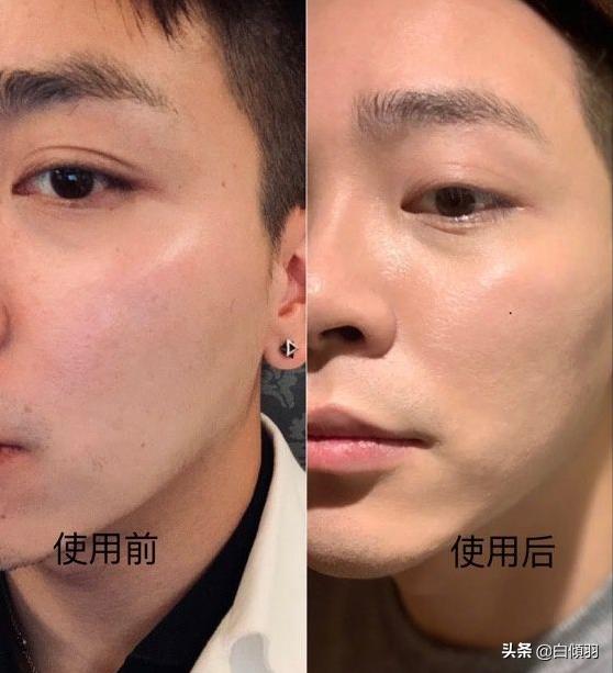 男生一定要好好护肤,男生好好护肤的重要性