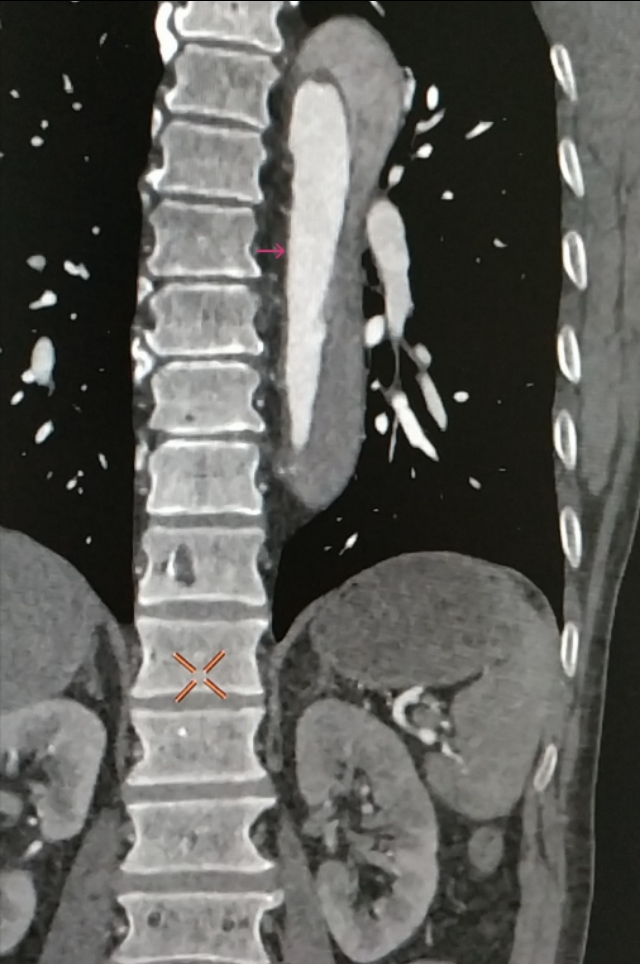 颠覆认知免费阅读全文,d-二聚体是检测什么