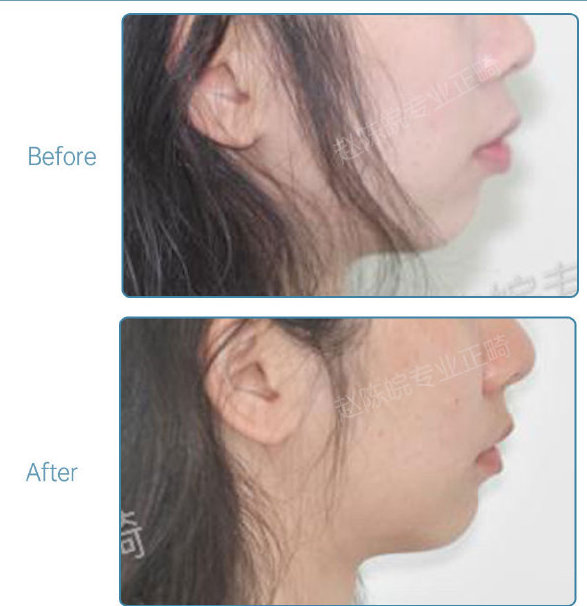 杭州口腔医院整牙,杭州整牙医生怎么选