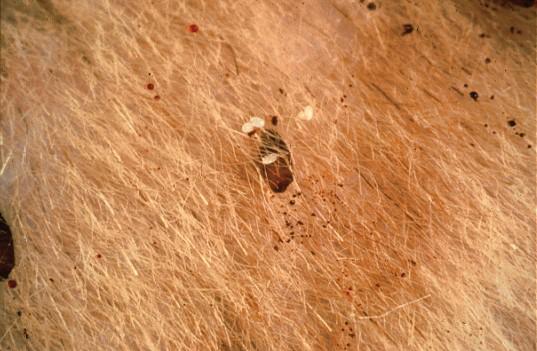 被什么虫子叮了会有一阵的刺痛感,各种虫子叮咬后的症状