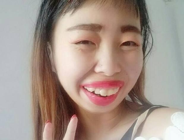 小孩牙齿恒牙长歪了怎么办,小孩牙齿长歪了要怎么矫正