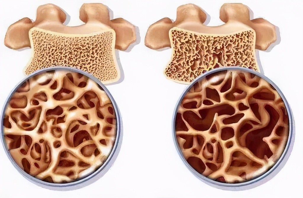 翻身痛坐起来也痛是怎么回事呀,呼吸翻身疼痛是什么原因