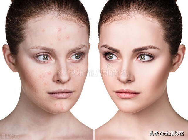 白醋八角的妙用,白醋的6个妙用