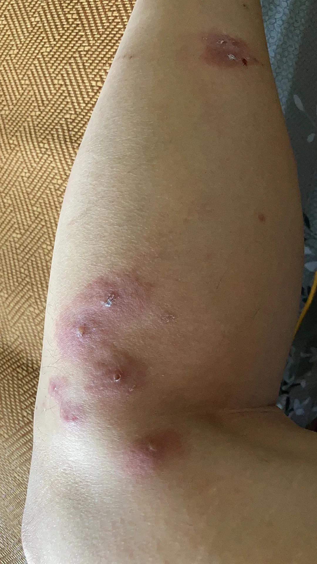 小咬蠓虫天敌,小咬蠓虫照片