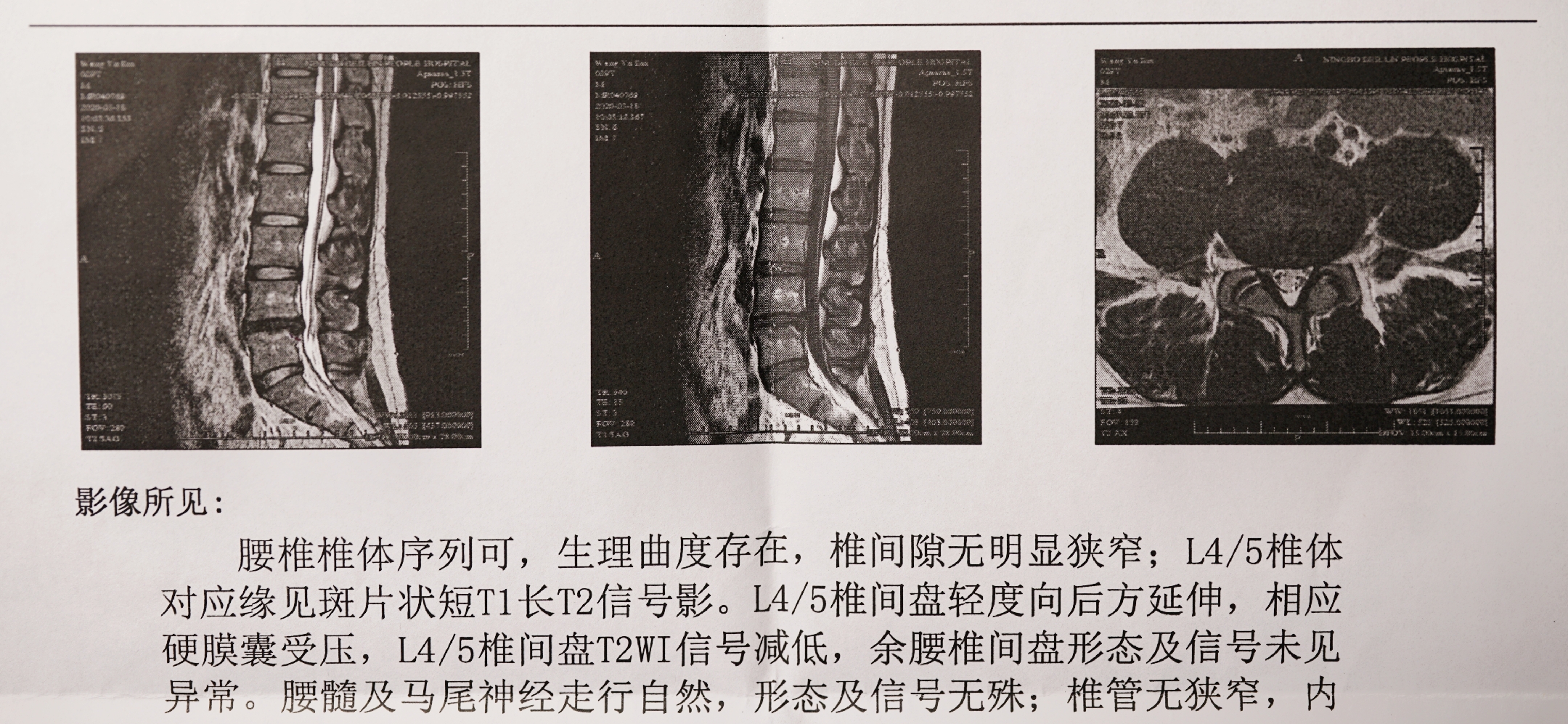 搴婂灚鎺ㄨ崘娣辩潯,涓冨勾搴婂灚