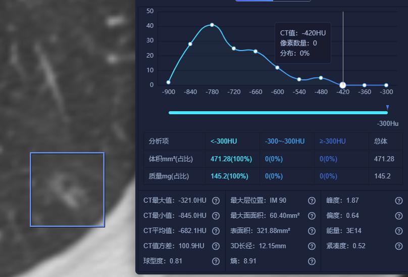 肺结节看诊（七）：这个肺结节手术太及时，空泡征小结节要注意