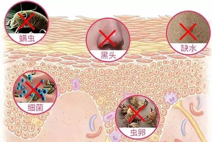 专治螨虫的洗面奶,螨虫专用洁面乳