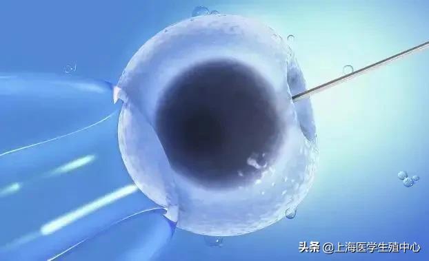 试管知识|穿刺取卵疼不疼，对身体有什么影响？