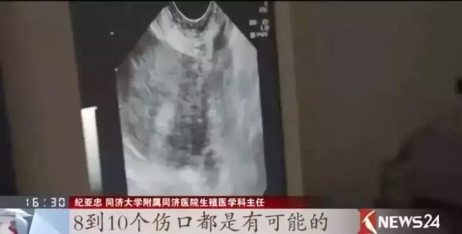 裸贷女生案件真实背后的心理问题,被逼死的网贷女孩