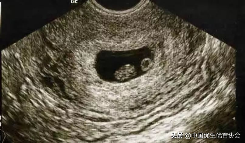 医生如何判断怀孕了,医生无法判断怀孕