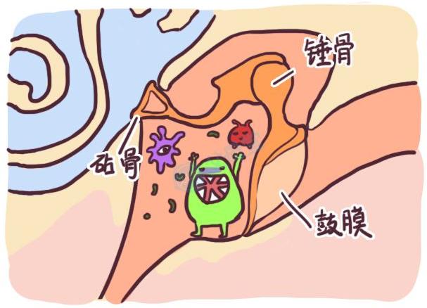 1.5岁孩子患中耳炎,一岁半宝宝得中耳炎的症状