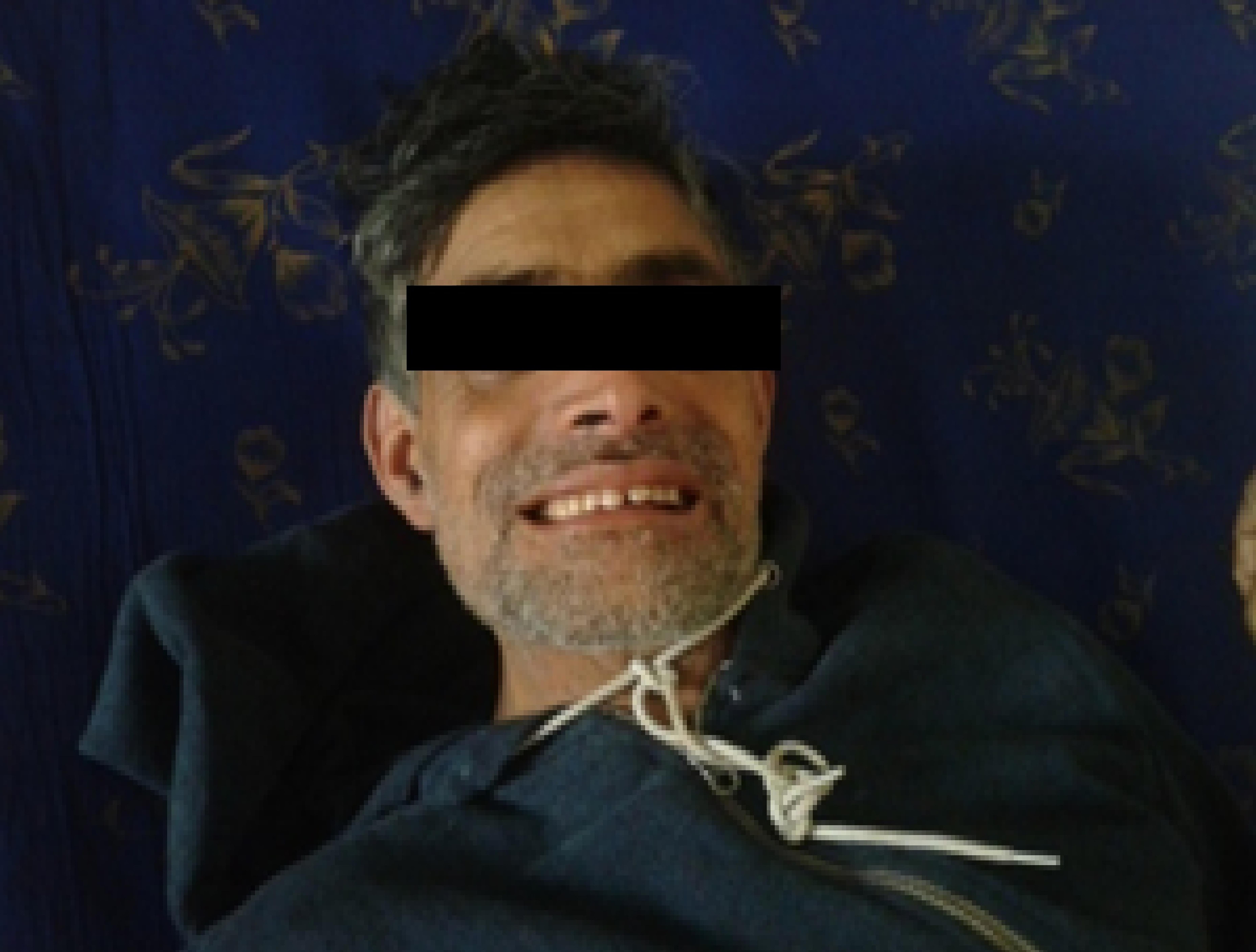 人类破伤风,人类怕破伤风吗