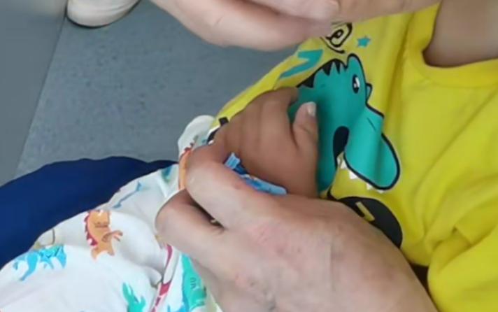 拇指多指手术后怎么护理,拇指漂浮指治疗康复案例