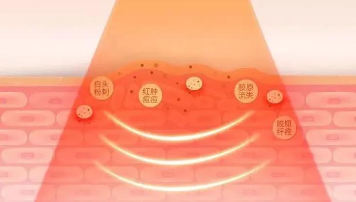 “38岁的年纪,18岁的脸”:能保持年轻的女人,手里少不了它