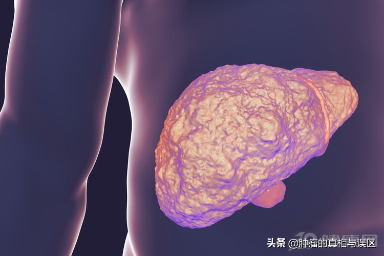 肝痛就是肝癌了吗,肝区疼痛怎样判断是肝痛还是胆痛