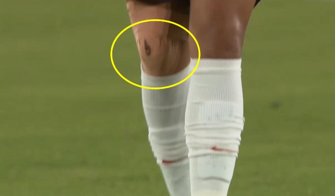 王霜受伤离场视频,王霜受伤训练视频