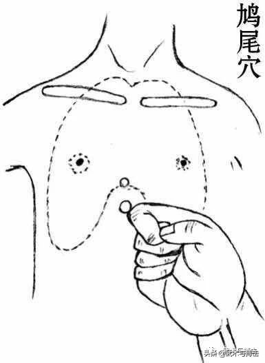点穴术实战技巧,点穴术8式绝招动图教学