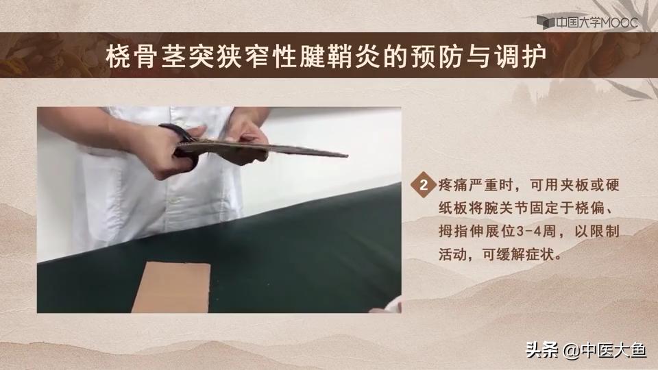 桡骨茎突狭窄性腱鞘炎怎么治疗,桡骨茎突狭窄性腱鞘炎治疗方法