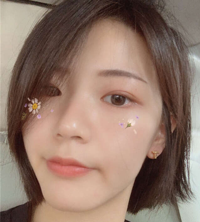 12岁男孩脸上长闭口粉刺如何去掉,脸上一直长闭口粉刺怎么办