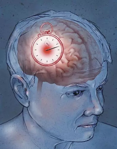 女性中风偏瘫恢复,45岁女子中风后遗症