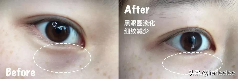 去细纹哪款眼霜值得入手百元内,又方便又好用的一款眼霜