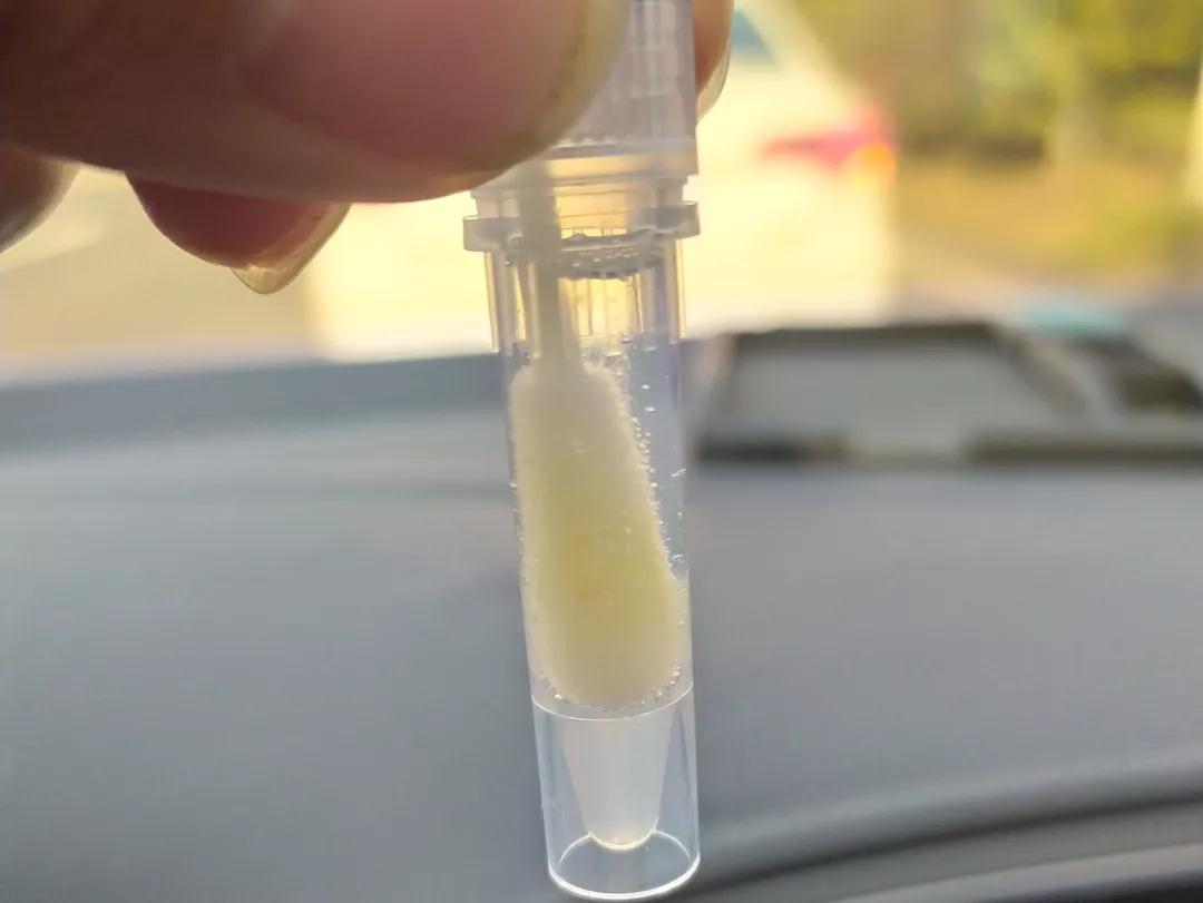 埃博拉病毒有多恐怖死了多少人,埃博拉病毒所致疾病