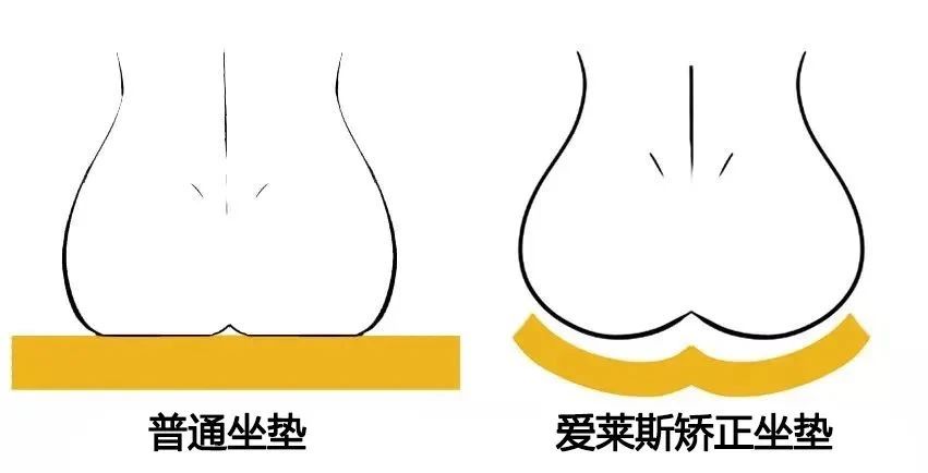 站立臀部凹陷假胯宽最有效的锻炼,避免臀凹陷和假胯宽的正确坐姿