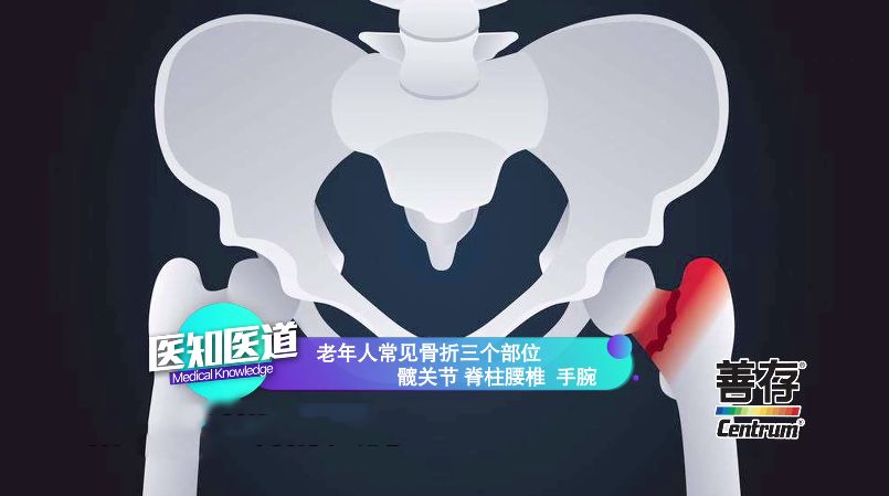 路滑老人摔倒后容易出现的情况,导致老人摔倒有哪些危险的地方