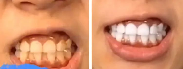 抖音上卖的竹炭牙膏,网红骗局竹炭牙膏是真的吗