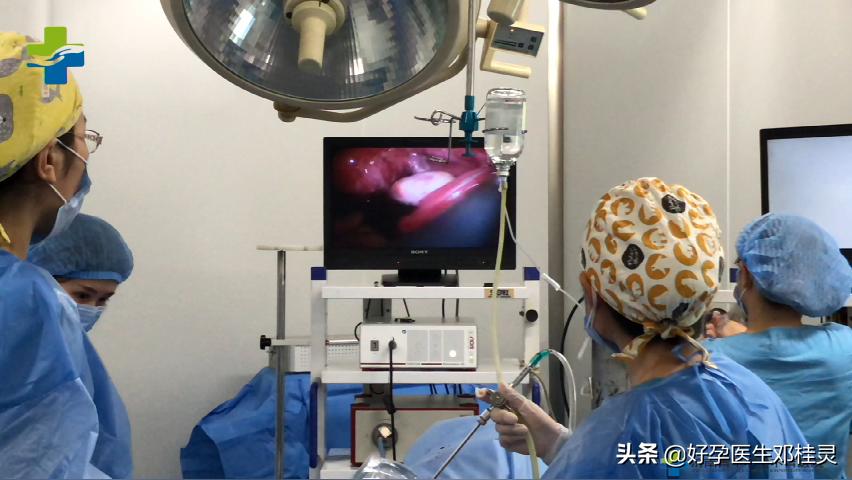 复查输卵管是否通畅必须做造影吗,检查输卵管通畅有必要查宫腔镜吗