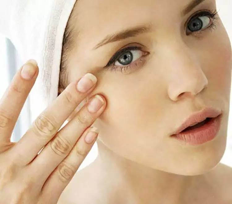 眼袋重显老去眼袋的方法,眼袋很重怎么治