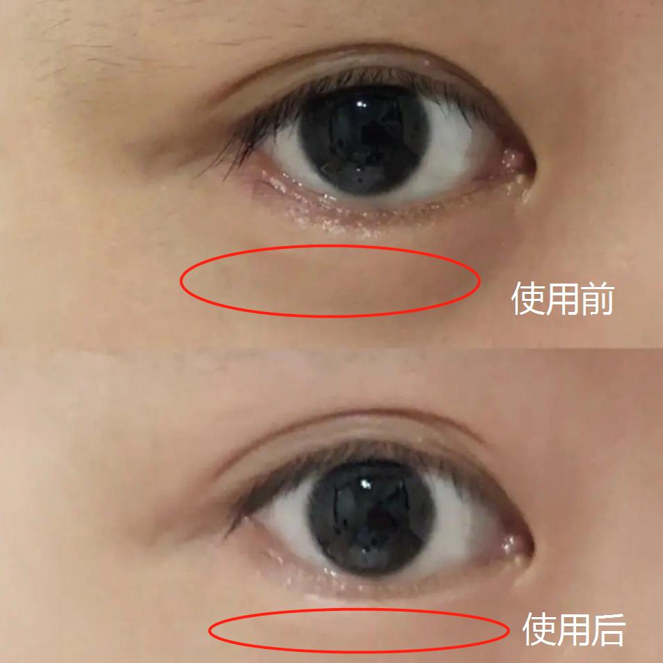 肖战王一博贴眼膜,肖战贴眼膜正确方法