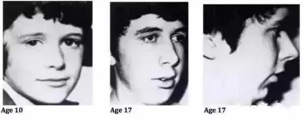 长期口呼吸的人是不是很没出息,长期口呼吸让人变丑