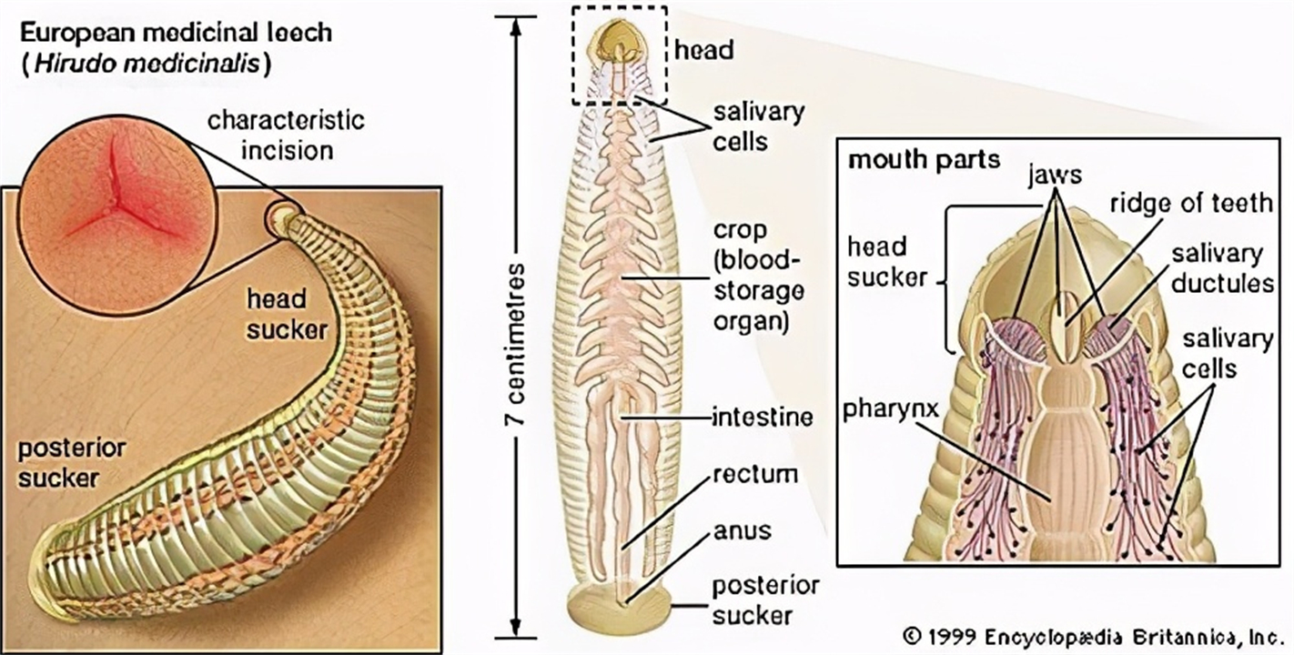 水蛭被人吃进肚子里它能活多久,水蛭误吃进肚子里怎么办