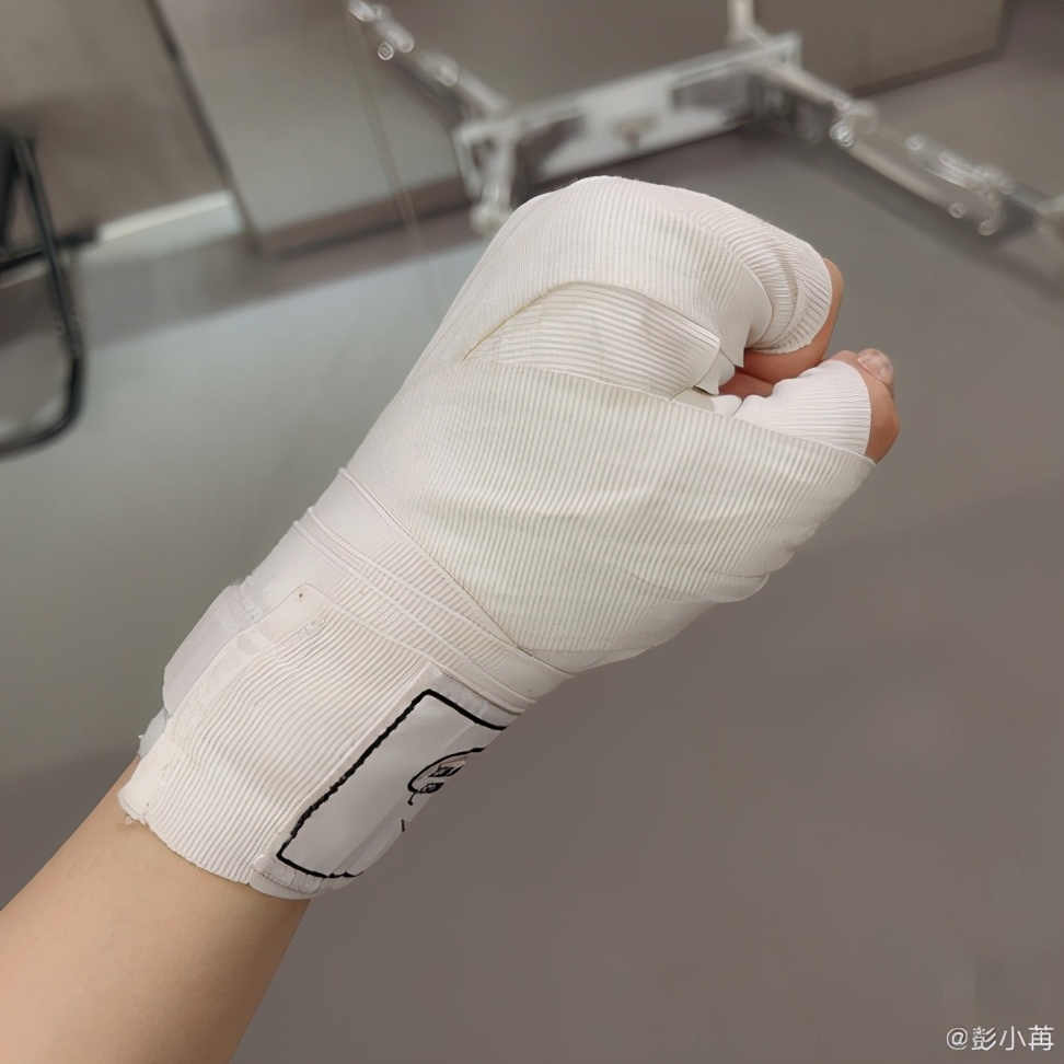 太心疼!30岁女星为减肥练拳击,双手受伤破皮,淤青严重恐留疤