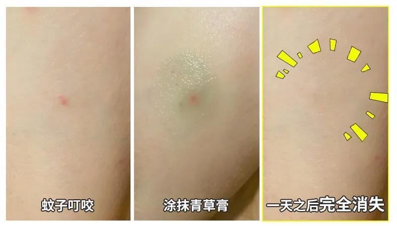 泰国青草止痒膏正品方便携带,夏季必备泰国青草膏