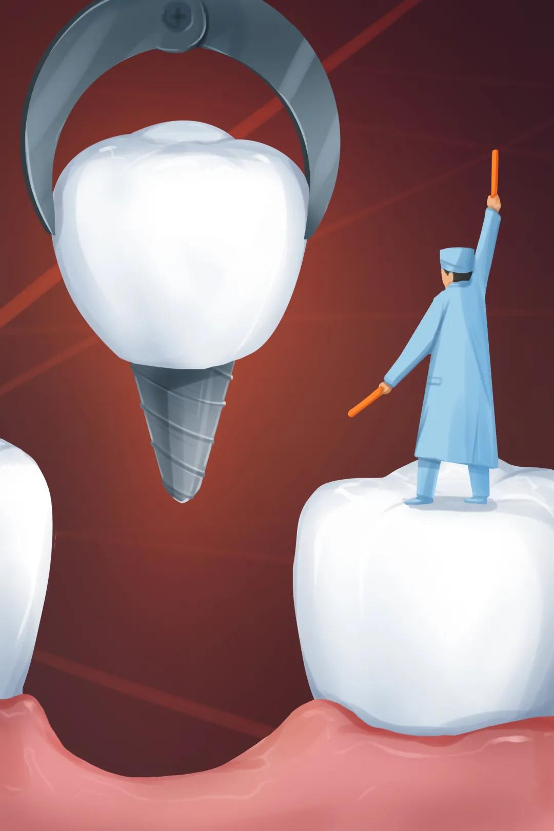 看一颗牙要多少钱啊,看一个牙需要多少钱