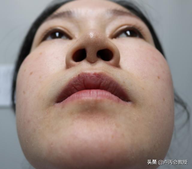 整形会有后遗症吗？为什么整形会上瘾