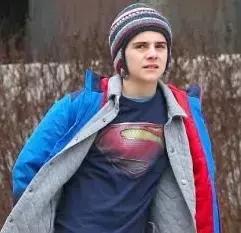 电击脱发,电击治疗斑秃