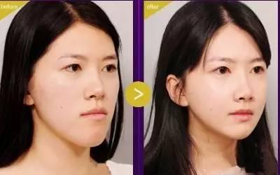 这份护牙指南建议每个人都看看,转存这份实用护牙指南