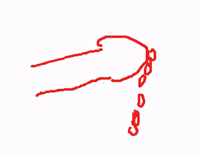 青春期频繁遗精会不育吗,青春期遗精会影响长高吗